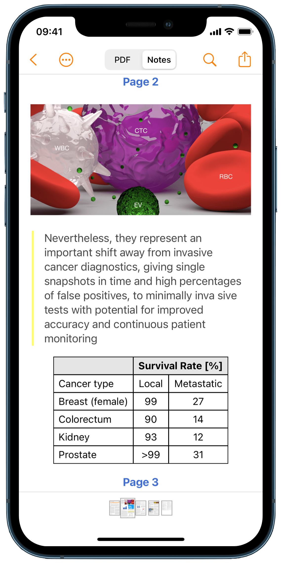 Notes view